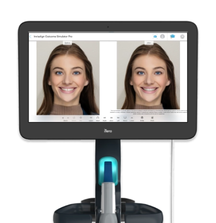 digital smile design