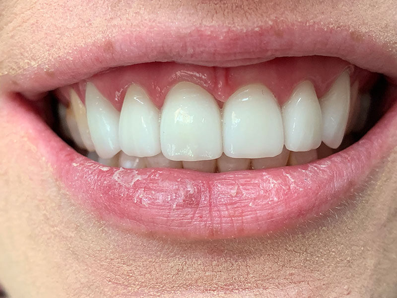 after treatment at JLM Dental Studios