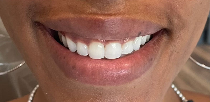 after treatment at JLM Dental Studios